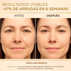 Sérum de ácido hialurónico